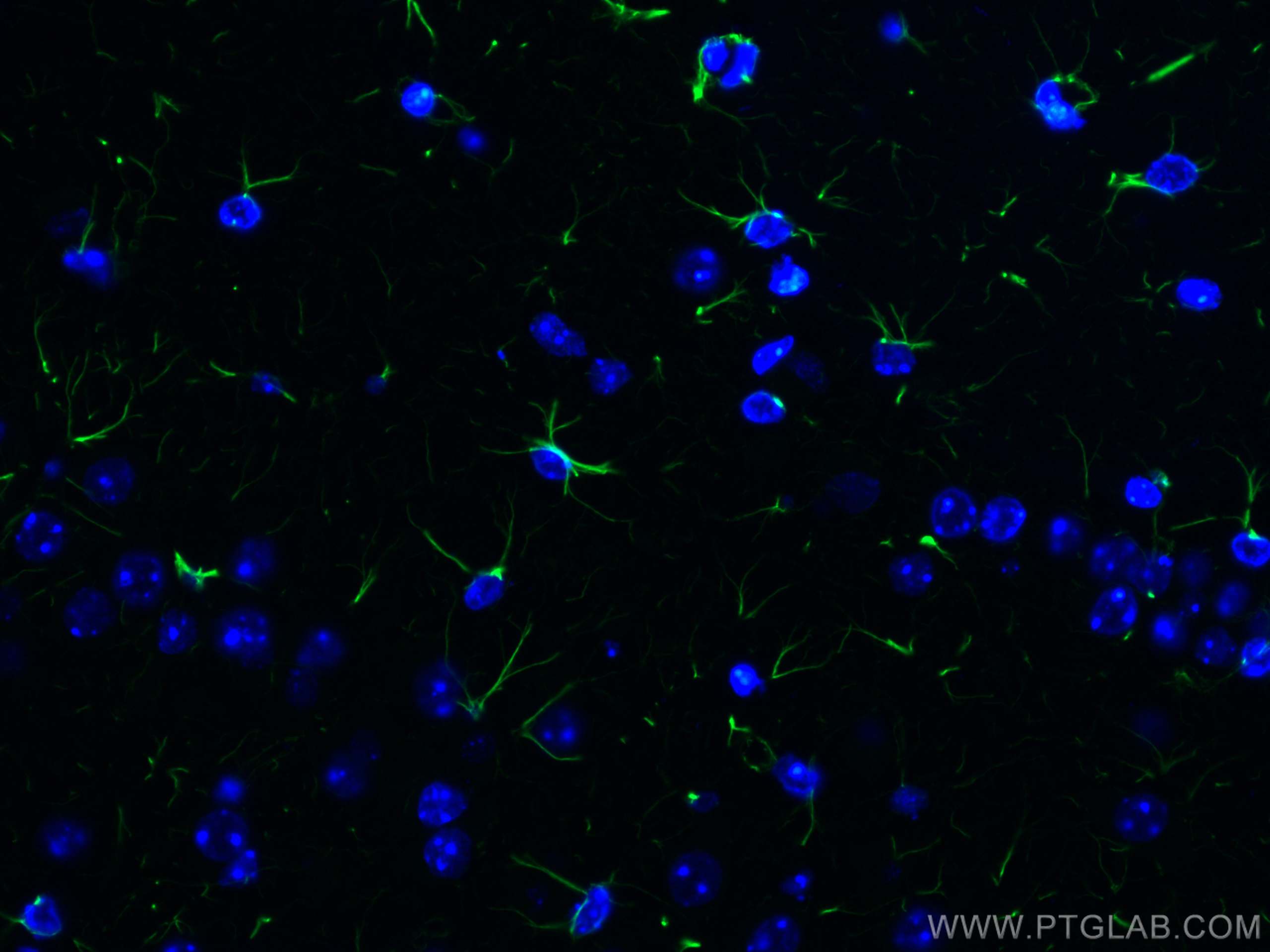 Immunofluorescence (IF) / fluorescent staining of mouse brain tissue using GFAP Recombinant antibody (81063-1-RR)