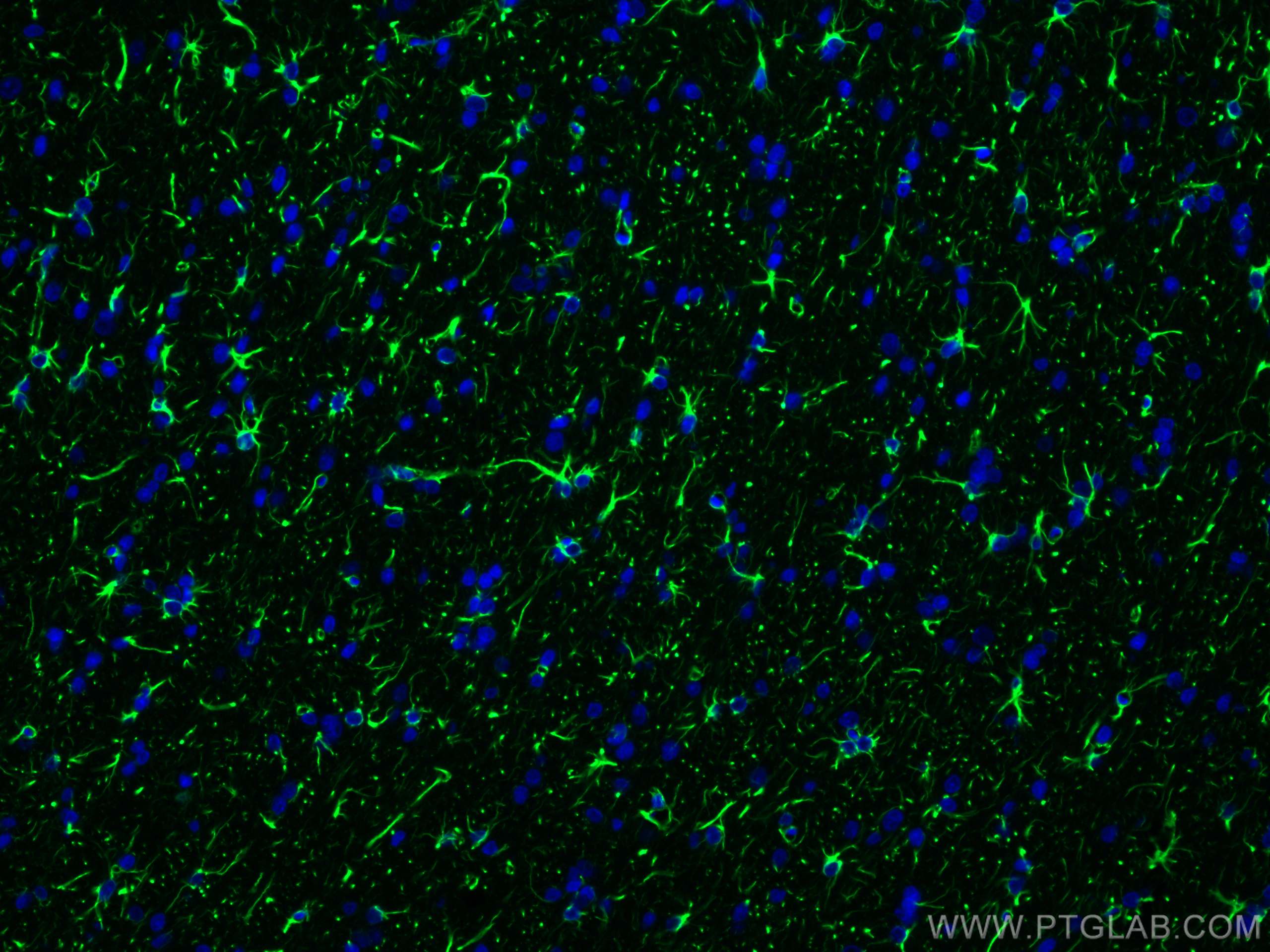 Immunofluorescence (IF) / fluorescent staining of rat brain tissue using GFAP Recombinant antibody (81063-1-RR)