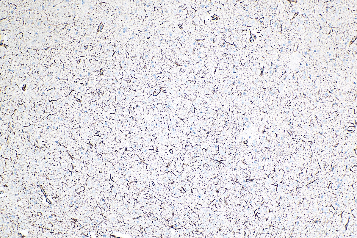 Immunohistochemistry (IHC) staining of rat brain tissue using GFAP Recombinant antibody (81063-1-RR)