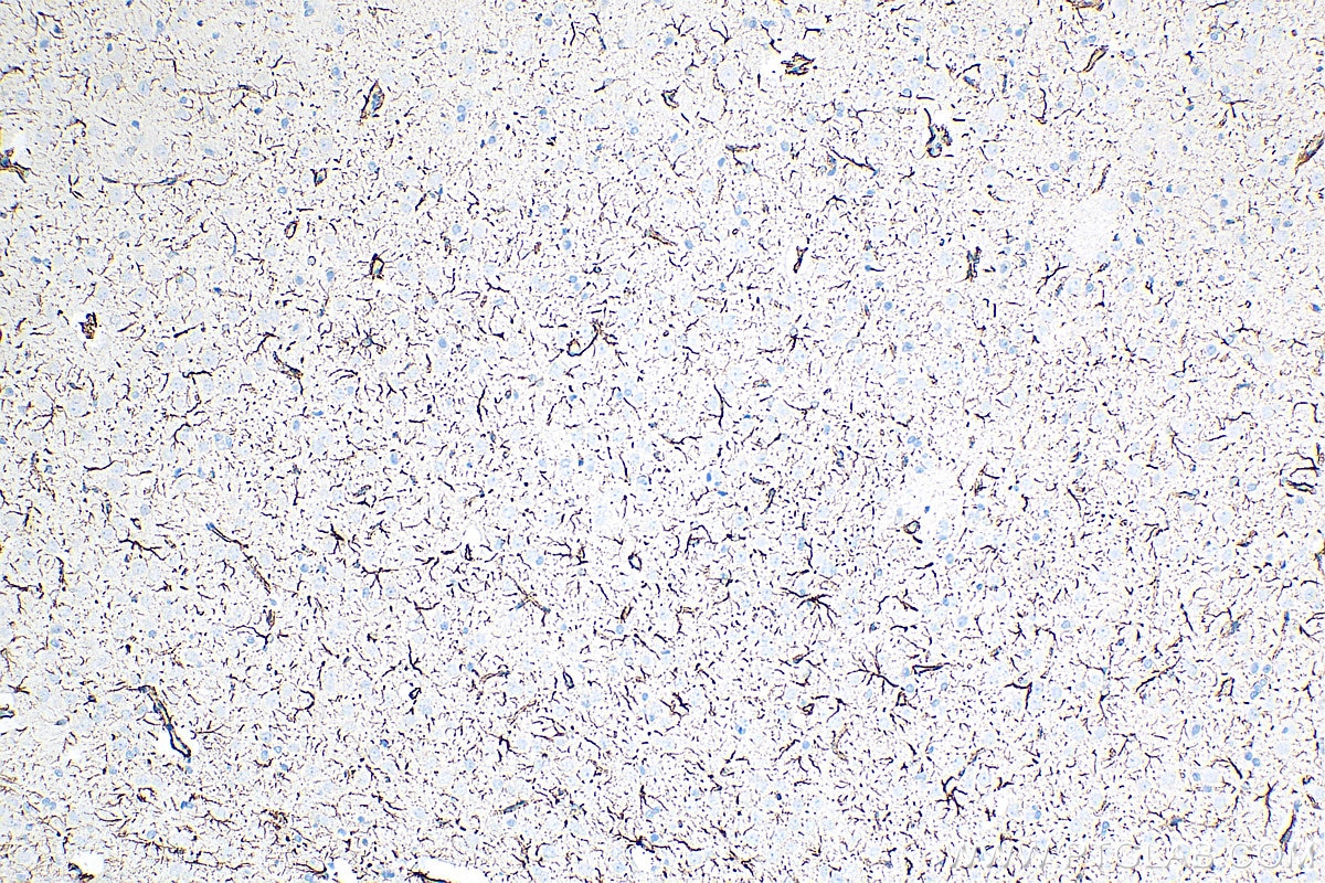 Immunohistochemistry (IHC) staining of rat brain tissue using GFAP Recombinant antibody (81063-1-RR)