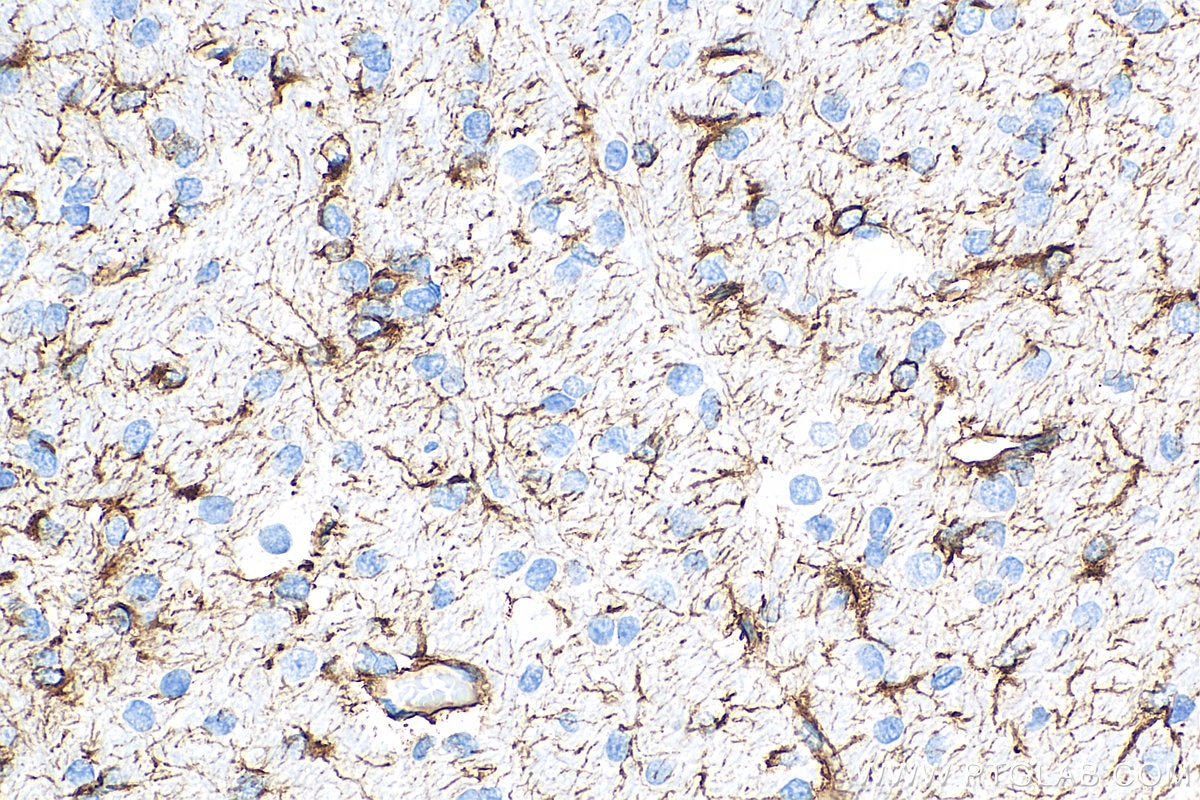 Immunohistochemistry (IHC) staining of rat brain tissue using GFAP Recombinant antibody (81063-1-RR)