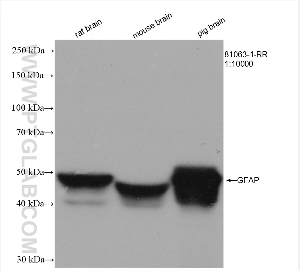 Western Blot (WB) analysis of various lysates using GFAP Recombinant antibody (81063-1-RR)
