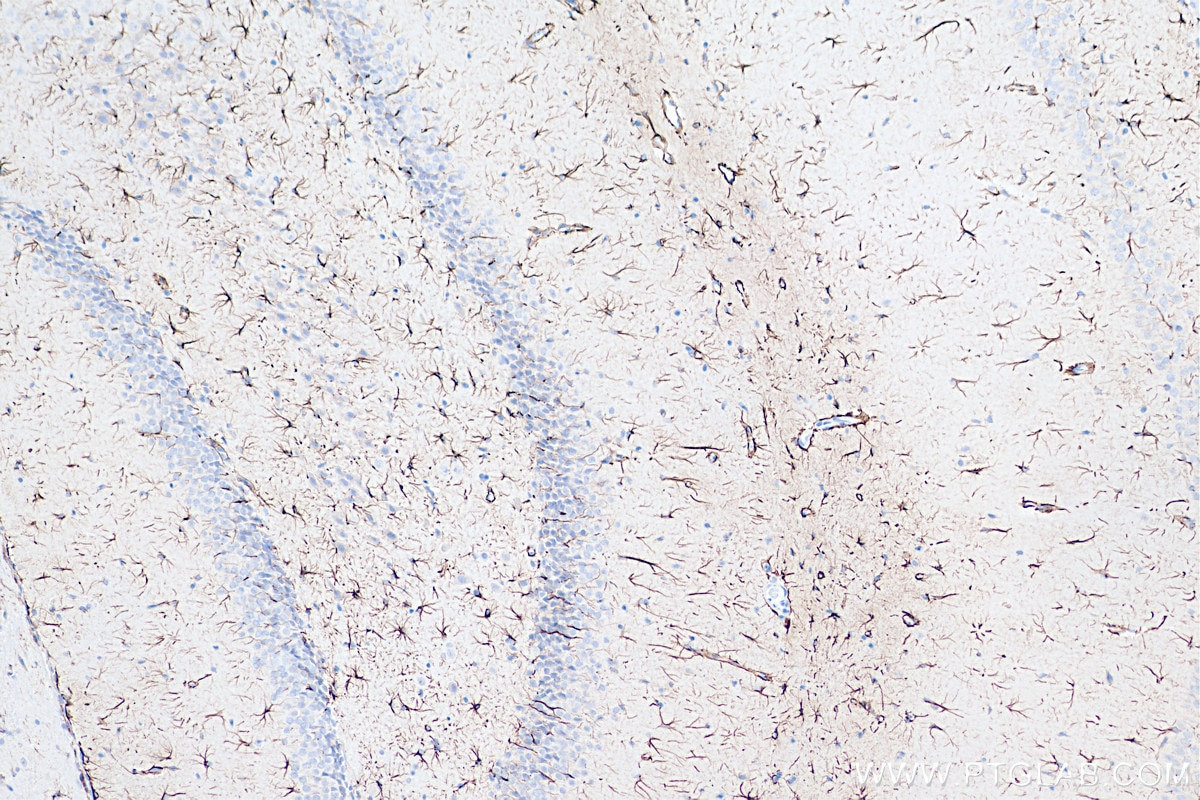 Immunohistochemistry (IHC) staining of rat brain tissue using Biotin-conjugated GFAP Monoclonal antibody (Biotin-60190)