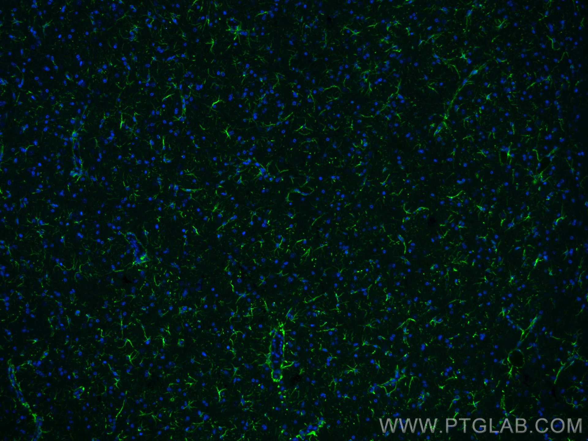 Immunofluorescence (IF) / fluorescent staining of rat brain tissue using CoraLite® Plus 488-conjugated GFAP Polyclonal anti (CL488-23935)