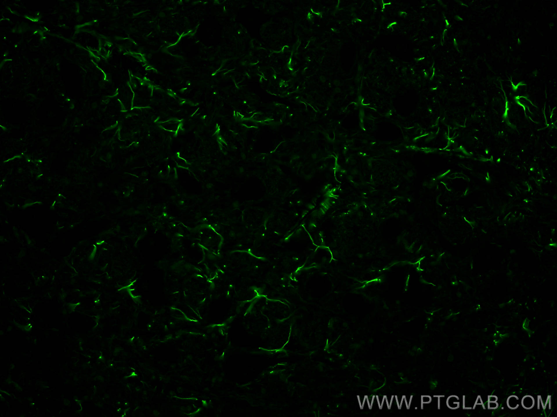 Immunofluorescence (IF) / fluorescent staining of rat brain tissue using CoraLite® Plus 488-conjugated GFAP Polyclonal anti (CL488-23935)