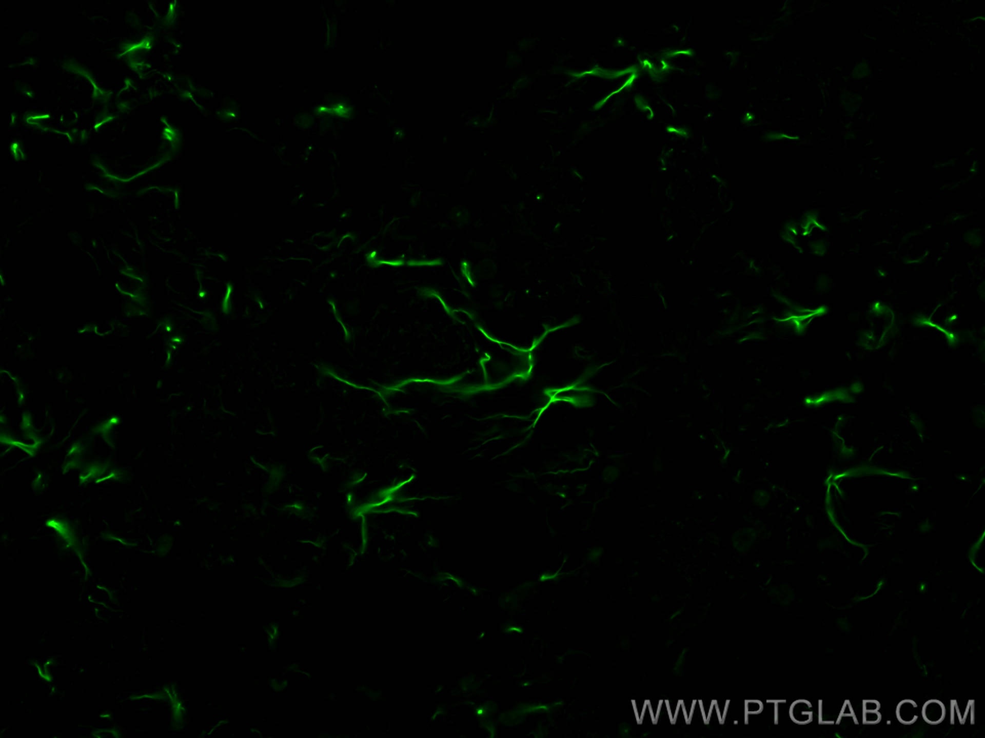 Immunofluorescence (IF) / fluorescent staining of rat brain tissue using CoraLite® Plus 488-conjugated GFAP Polyclonal anti (CL488-23935)