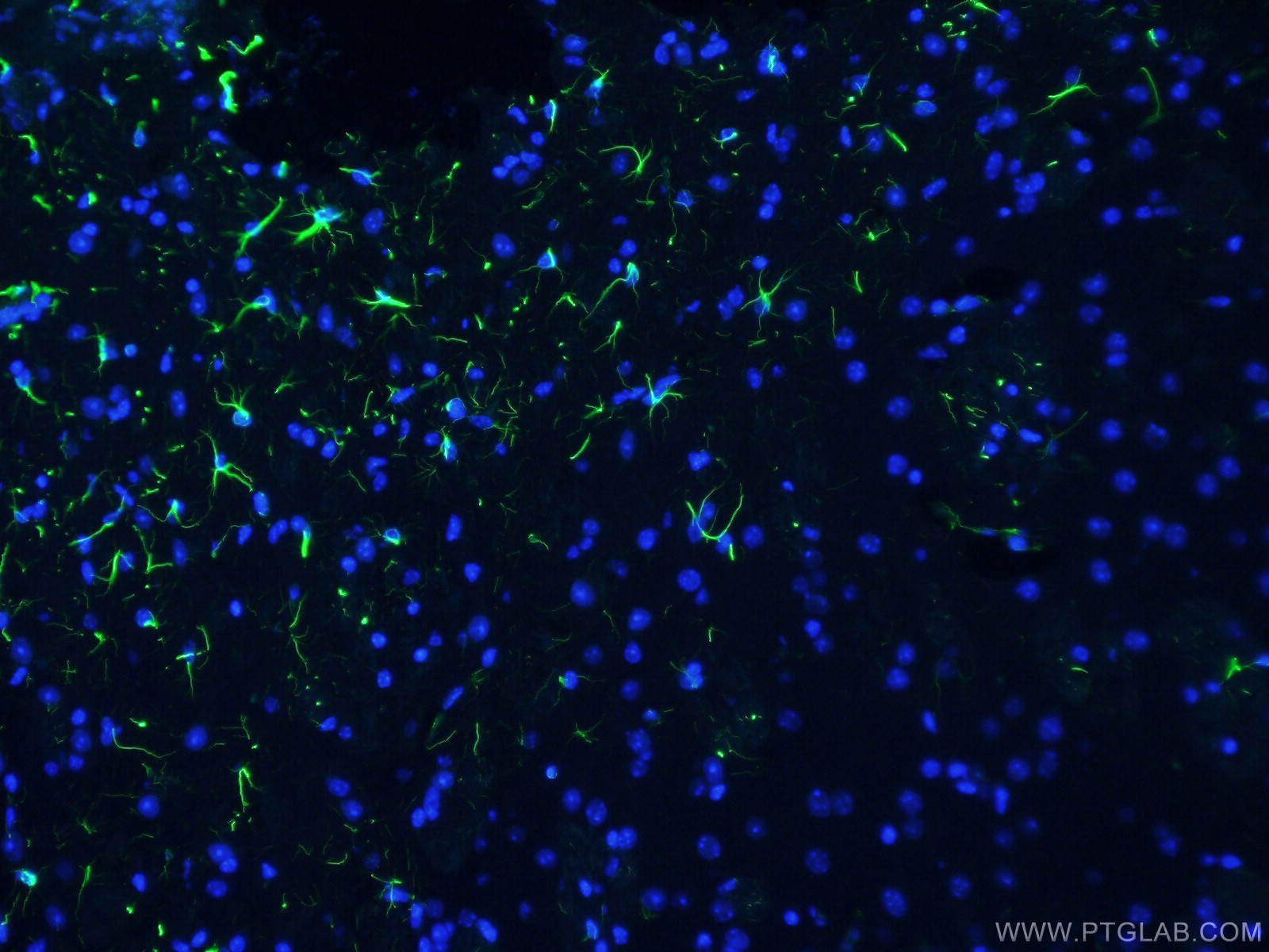 IF Staining of mouse brain using CL488-60190