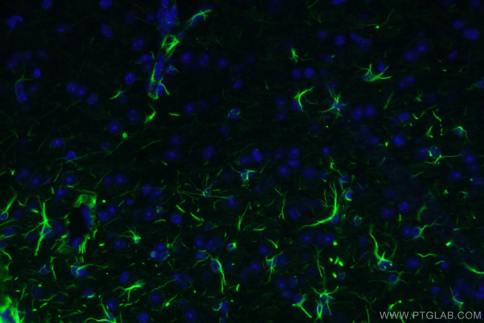 Immunofluorescence (IF) / fluorescent staining of mouse brain tissue using CoraLite® Plus 488-conjugated GFAP Monoclonal anti (CL488-60190)