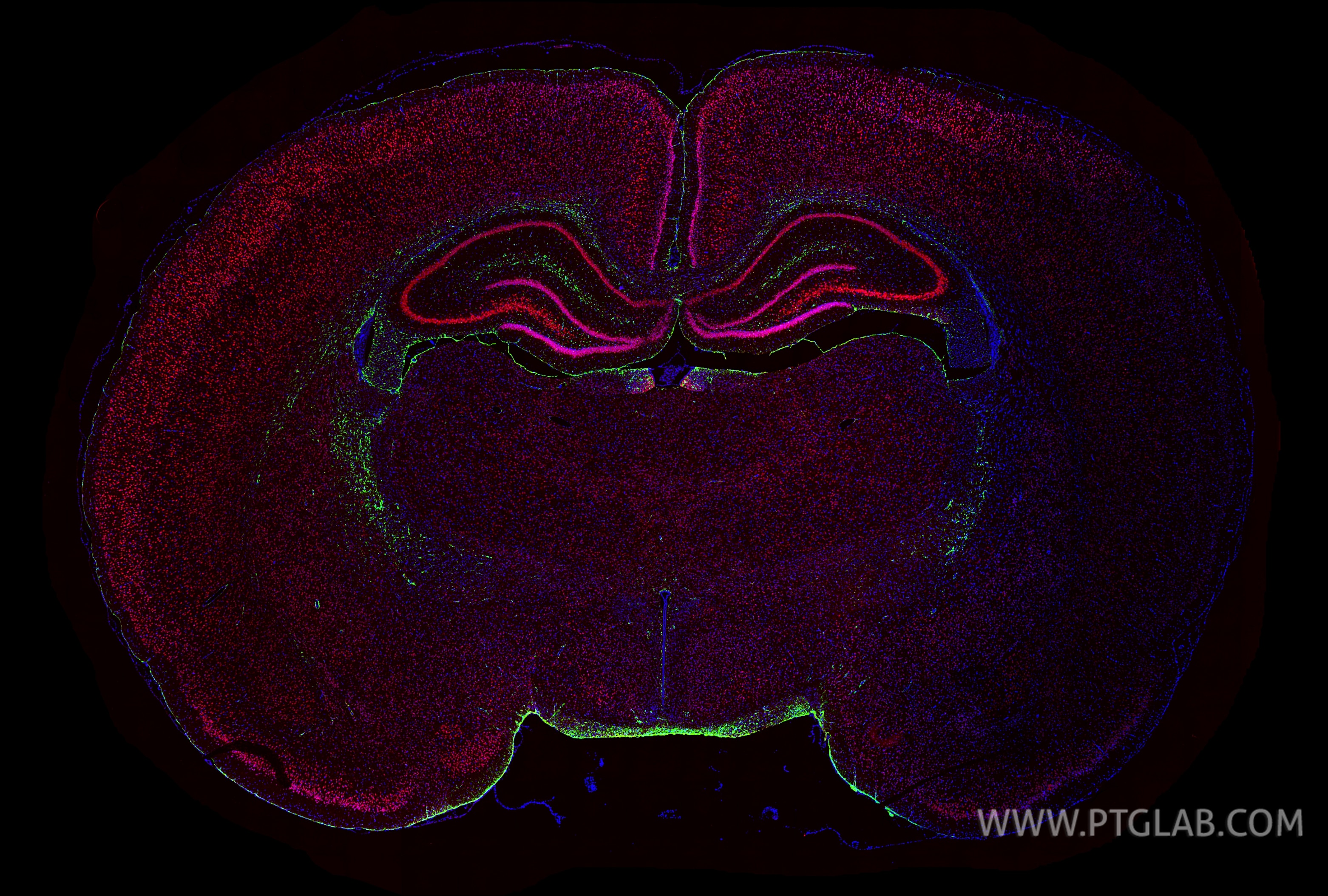 Immunofluorescence (IF) / fluorescent staining of rat brain tissue using CoraLite® Plus 488-conjugated GFAP Monoclonal anti (CL488-60190)