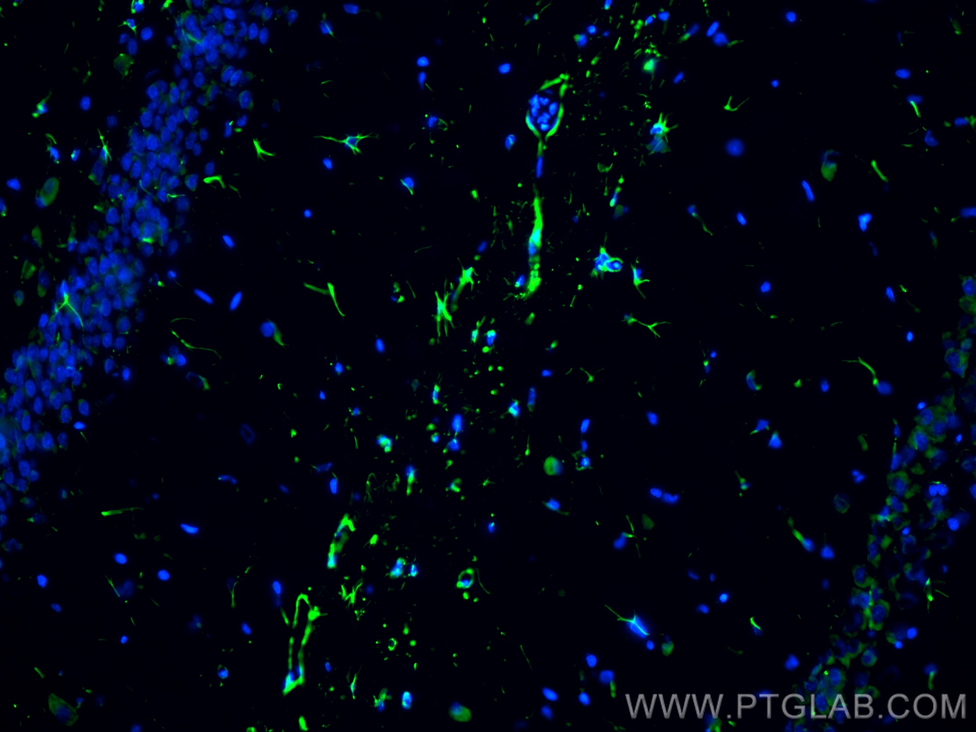 Immunofluorescence (IF) / fluorescent staining of rat brain tissue using CoraLite® Plus 488-conjugated GFAP Recombinant ant (CL488-81063)