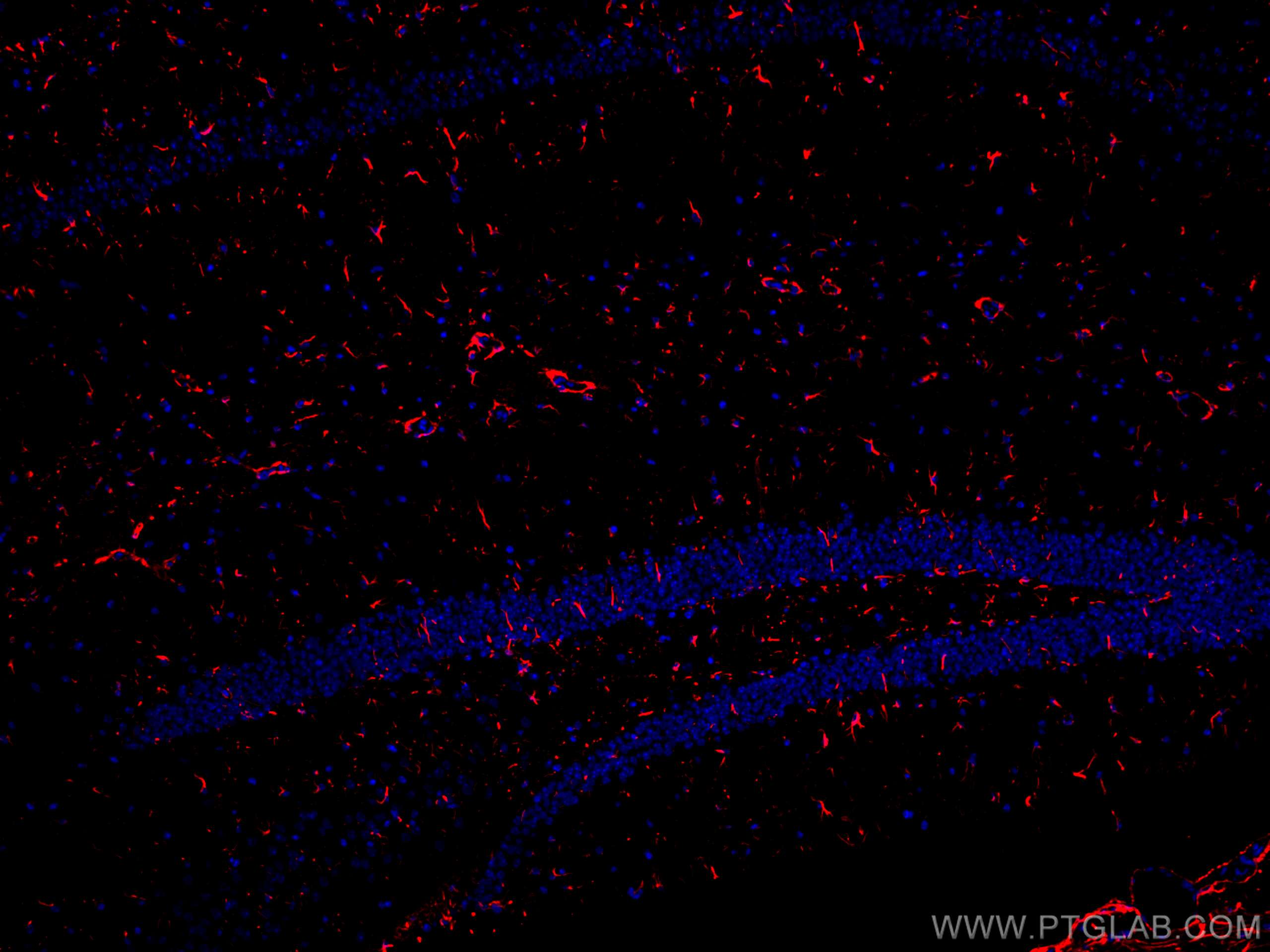 Immunofluorescence (IF) / fluorescent staining of mouse brain tissue using CoraLite®594-conjugated GFAP Polyclonal antibody (CL594-16825)