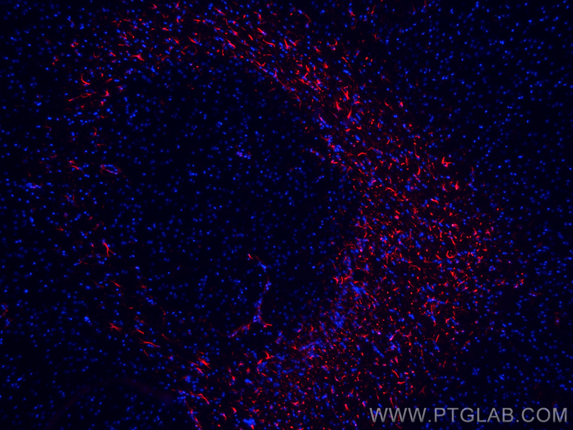 Immunofluorescence (IF) / fluorescent staining of mouse brain tissue using CoraLite®594-conjugated GFAP Polyclonal antibody (CL594-23935)