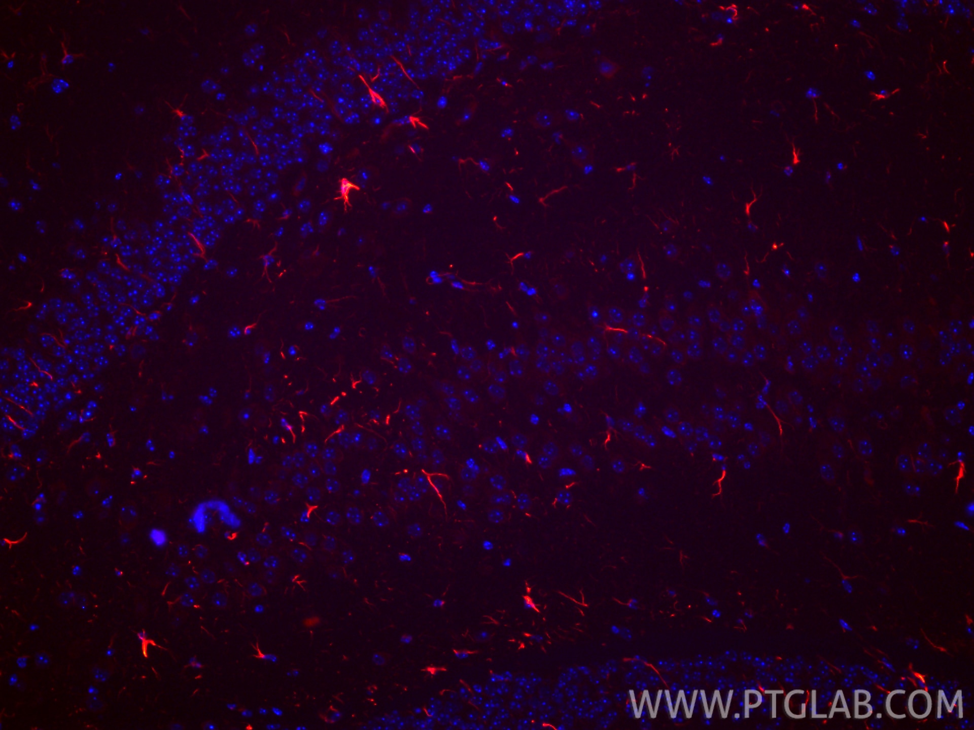 Immunofluorescence (IF) / fluorescent staining of mouse brain tissue using CoraLite®594-conjugated GFAP Recombinant antibody (CL594-81063)