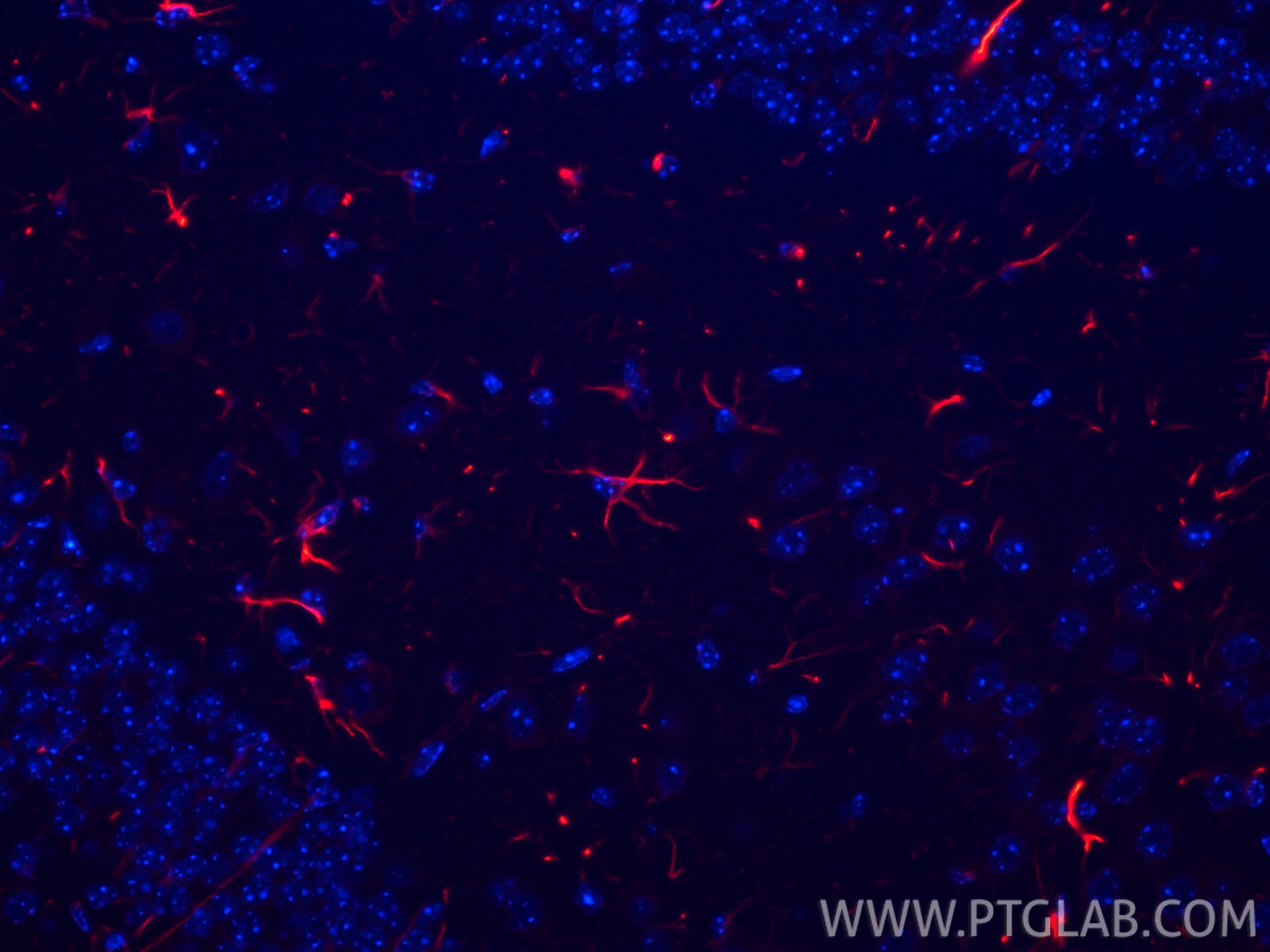 Immunofluorescence (IF) / fluorescent staining of mouse brain tissue using CoraLite®594-conjugated GFAP Recombinant antibody (CL594-81063)