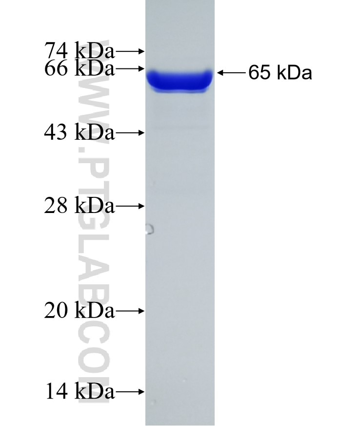 GFAP fusion protein Ag10423 SDS-PAGE