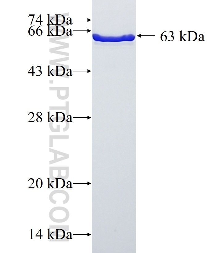 GFAP fusion protein Ag10423 SDS-PAGE