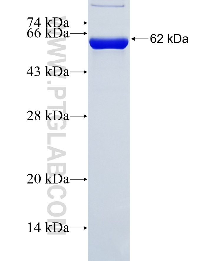 GFAP fusion protein Ag20853 SDS-PAGE