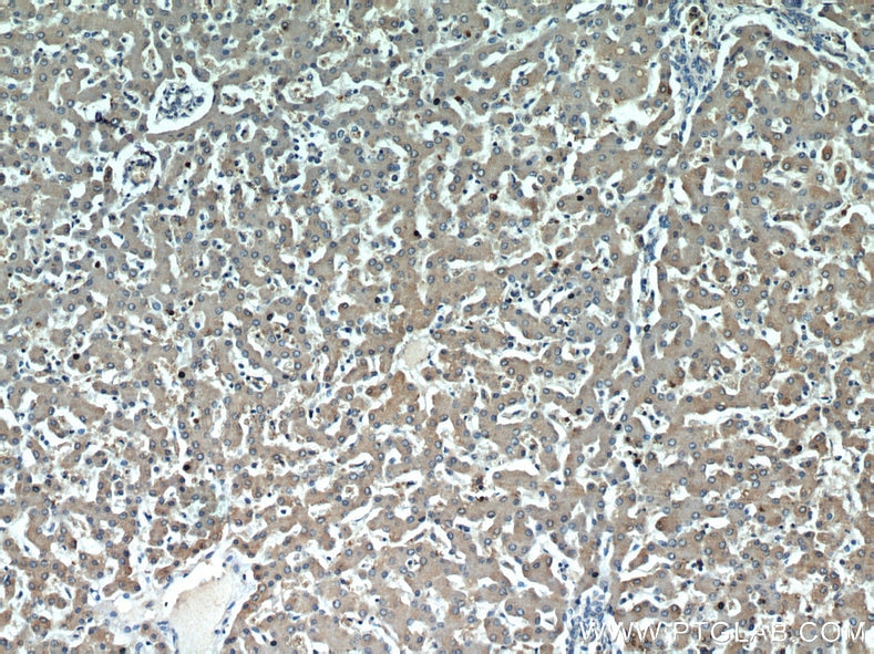 IHC staining of human liver using 11293-1-AP