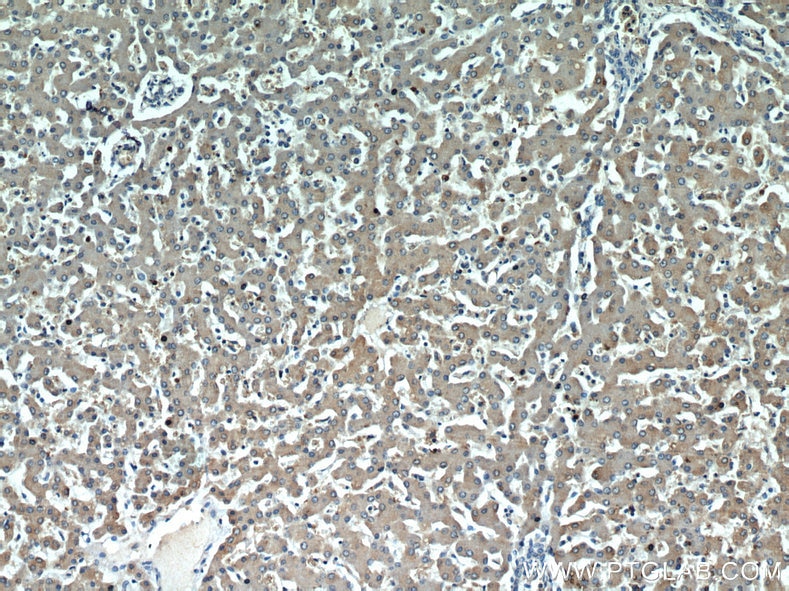 Immunohistochemistry (IHC) staining of human liver tissue using ALR Polyclonal antibody (11293-1-AP)