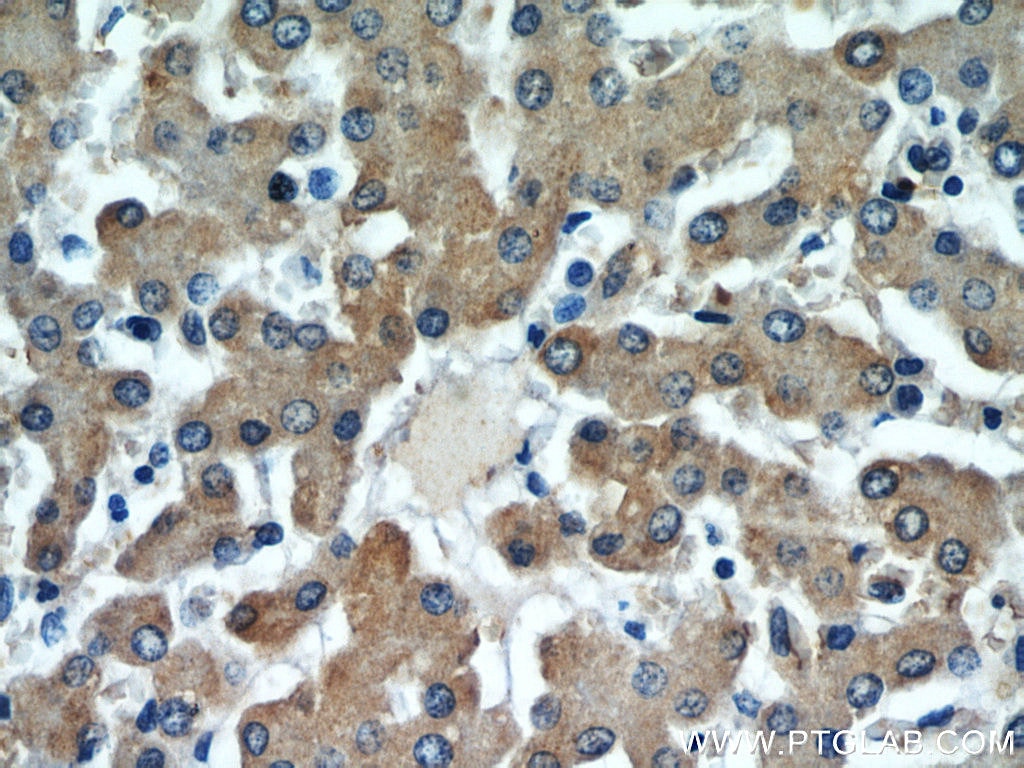Immunohistochemistry (IHC) staining of human liver tissue using ALR Polyclonal antibody (11293-1-AP)
