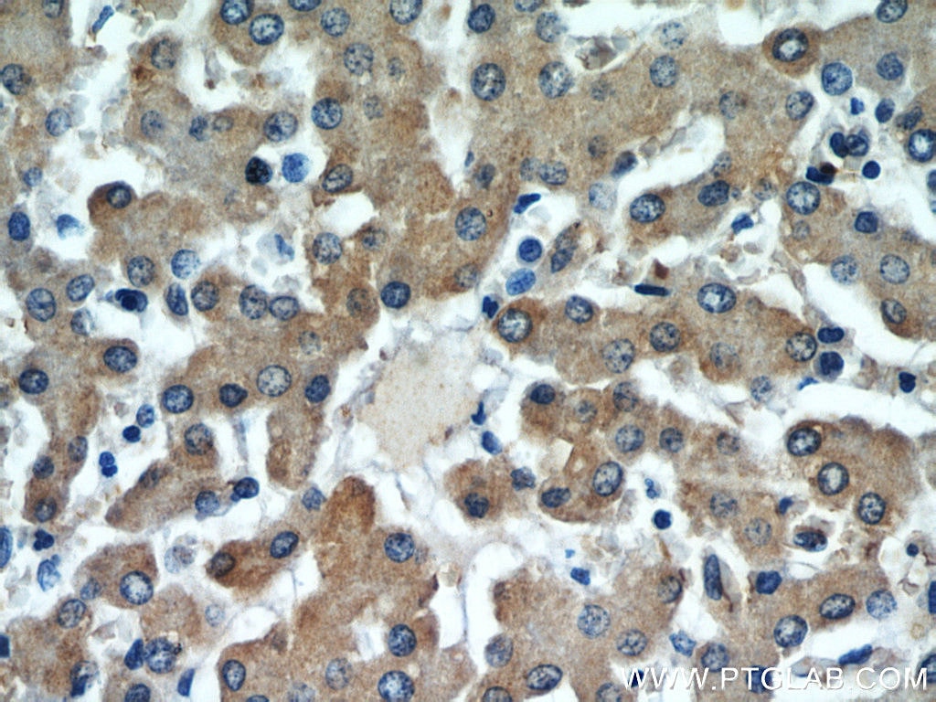 IHC staining of human liver using 11293-1-AP