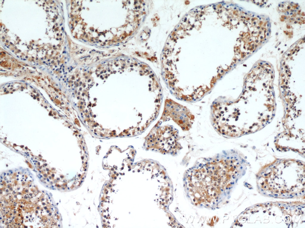 Immunohistochemistry (IHC) staining of human testis tissue using ALR Polyclonal antibody (11293-1-AP)