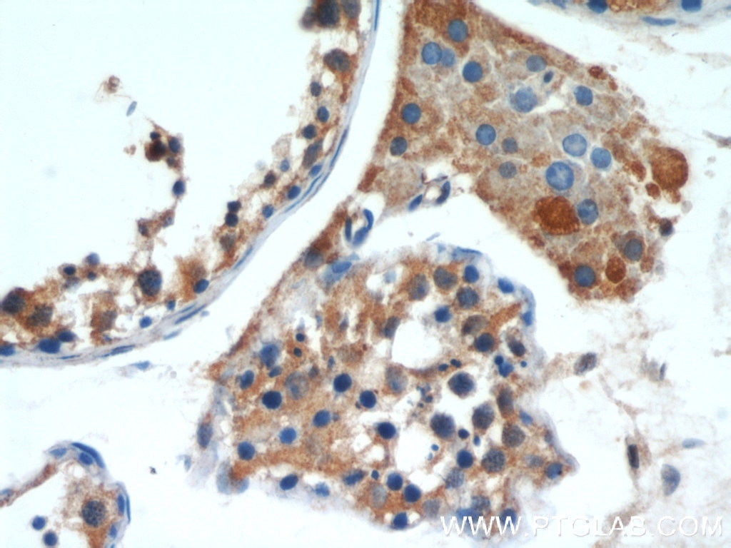 Immunohistochemistry (IHC) staining of human testis tissue using ALR Polyclonal antibody (11293-1-AP)