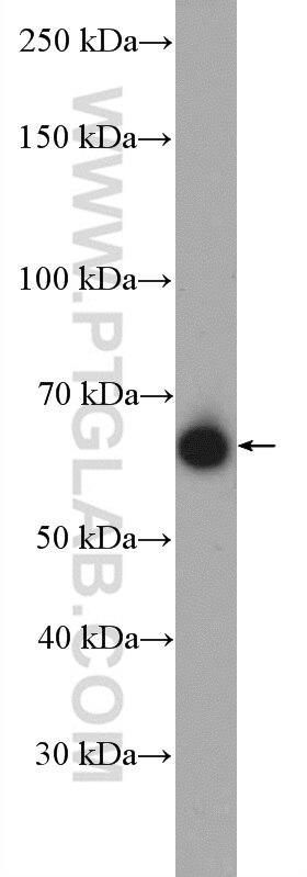 Western Blot (WB) analysis of mouse thymus tissue using GFI1 Polyclonal antibody (14198-1-AP)