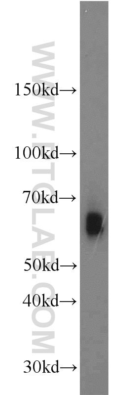 Western Blot (WB) analysis of K-562 cells using GFI1 Polyclonal antibody (14198-1-AP)