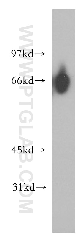 Western Blot (WB) analysis of K-562 cells using GFI1 Polyclonal antibody (14198-1-AP)