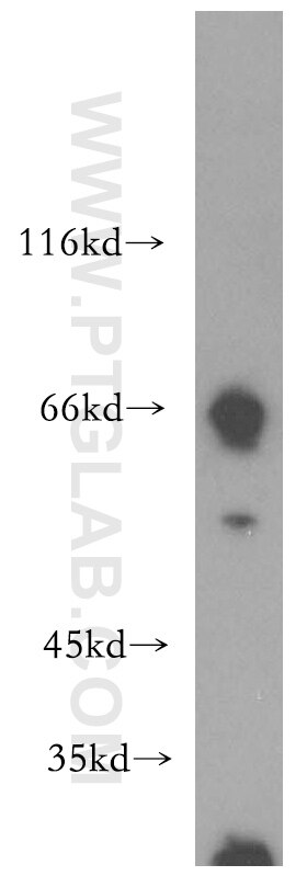 WB analysis of HL-60 using 14198-1-AP