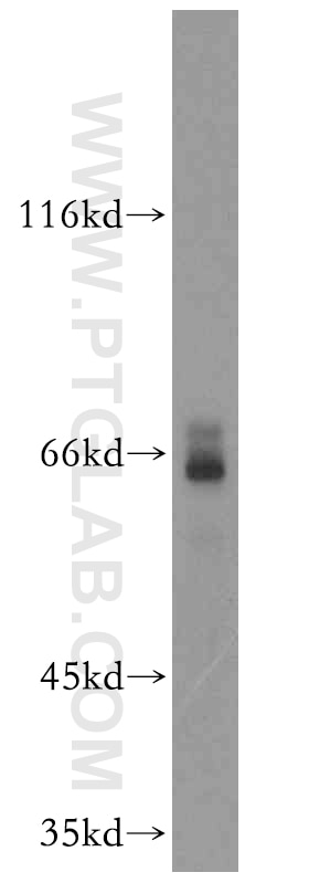 Western Blot (WB) analysis of Raji cells using GFI1 Polyclonal antibody (14198-1-AP)