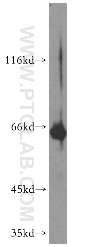 Western Blot (WB) analysis of HL-60 cells using GFI1 Polyclonal antibody (14198-1-AP)