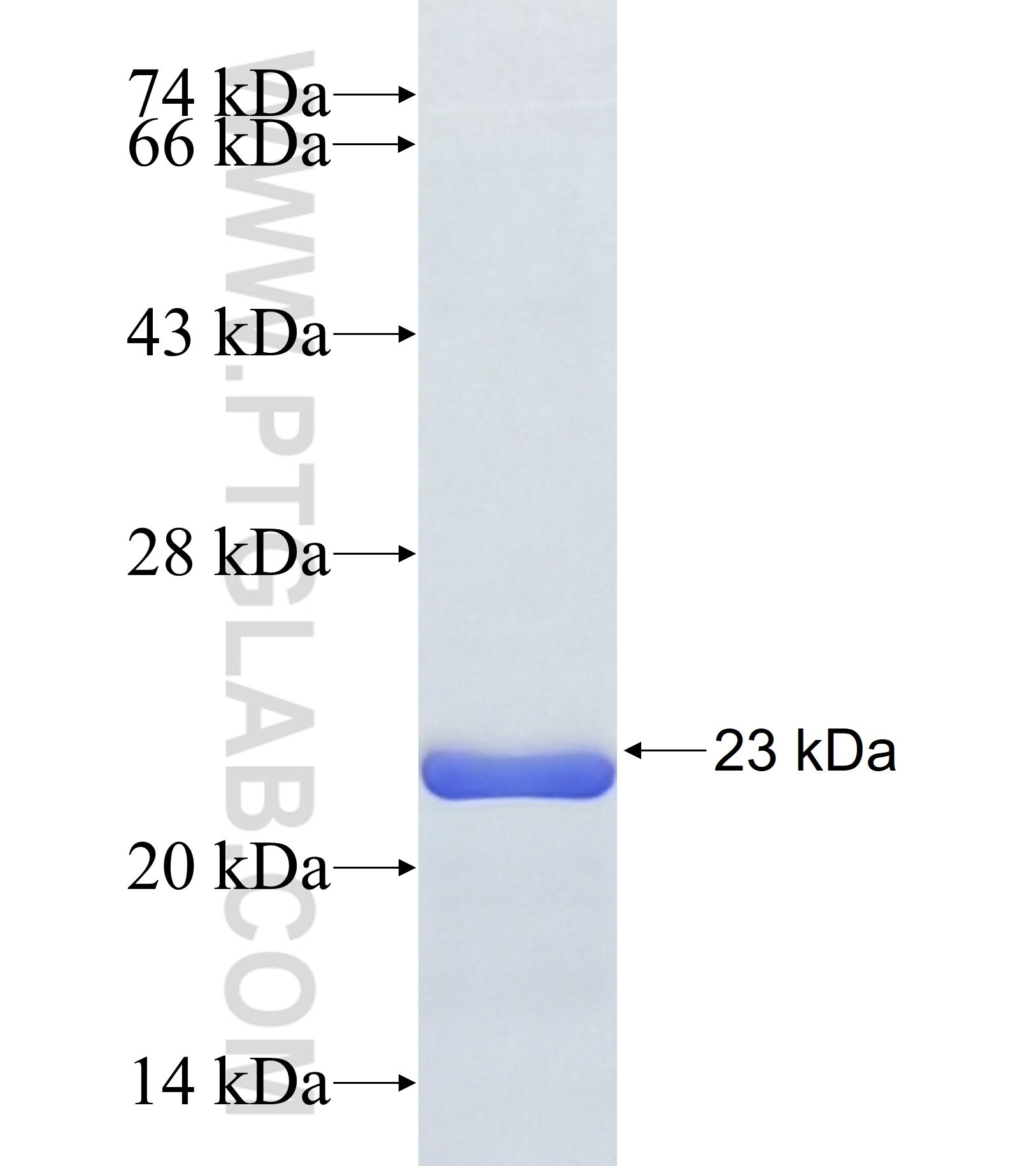 GFI1B fusion protein Ag38112 SDS-PAGE GFI1B fusion protein Ag38112 SDS-PAGE