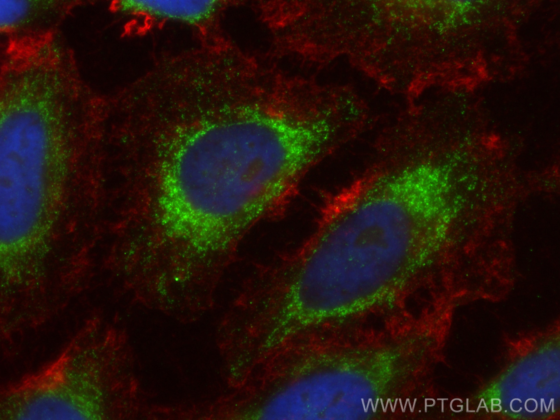 Immunofluorescence (IF) / fluorescent staining of HeLa cells using GFM1 Polyclonal antibody (14274-1-AP)