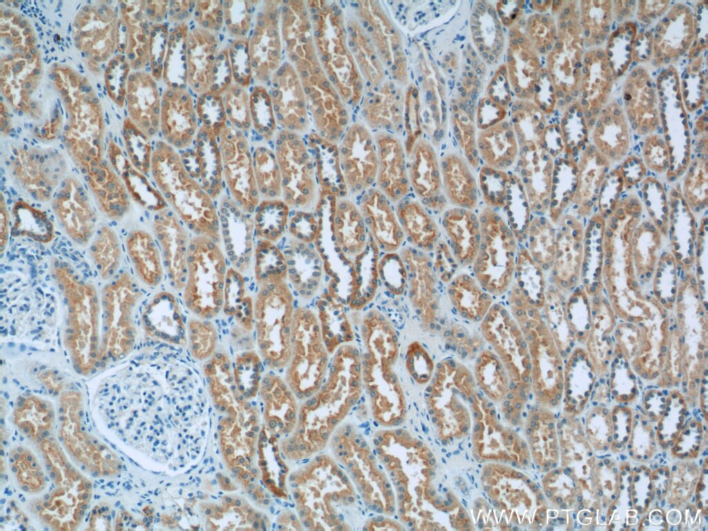 Immunohistochemistry (IHC) staining of human kidney tissue using GFM1 Polyclonal antibody (14274-1-AP)