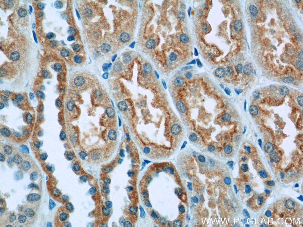 Immunohistochemistry (IHC) staining of human kidney tissue using GFM1 Polyclonal antibody (14274-1-AP)