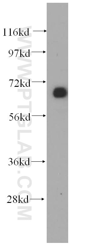 Western Blot (WB) analysis of mouse kidney tissue using GFM1 Polyclonal antibody (14274-1-AP)