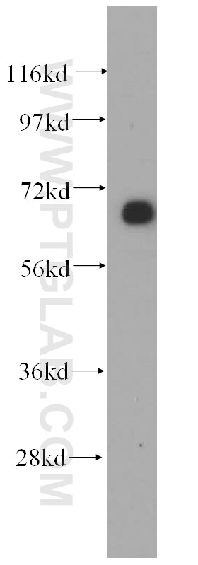 WB analysis of mouse kidney using 14274-1-AP