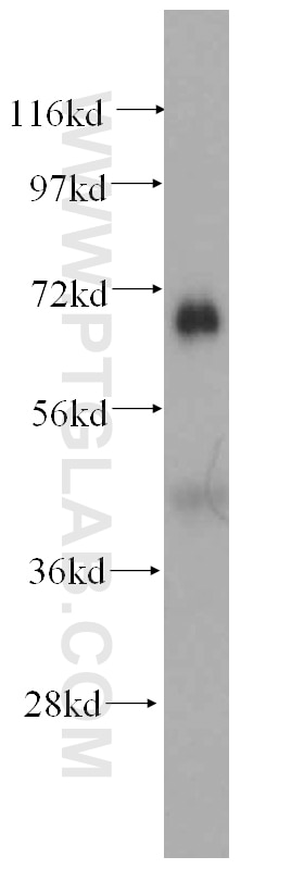 Western Blot (WB) analysis of human heart tissue using GFM1 Polyclonal antibody (14274-1-AP)
