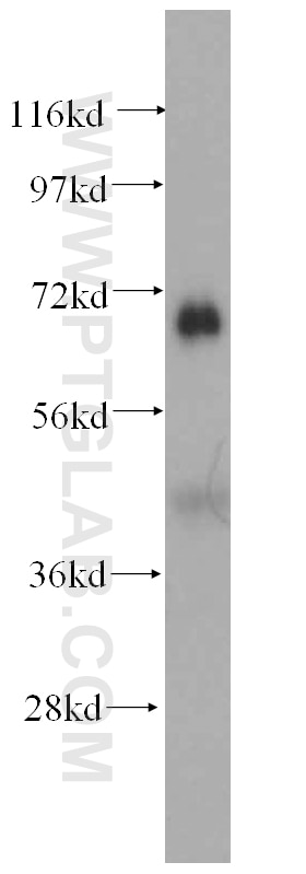 WB analysis of human heart using 14274-1-AP