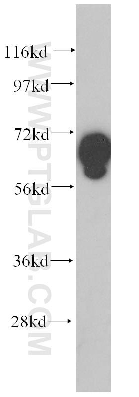 Western Blot (WB) analysis of HeLa cells using GFM1 Polyclonal antibody (14274-1-AP)