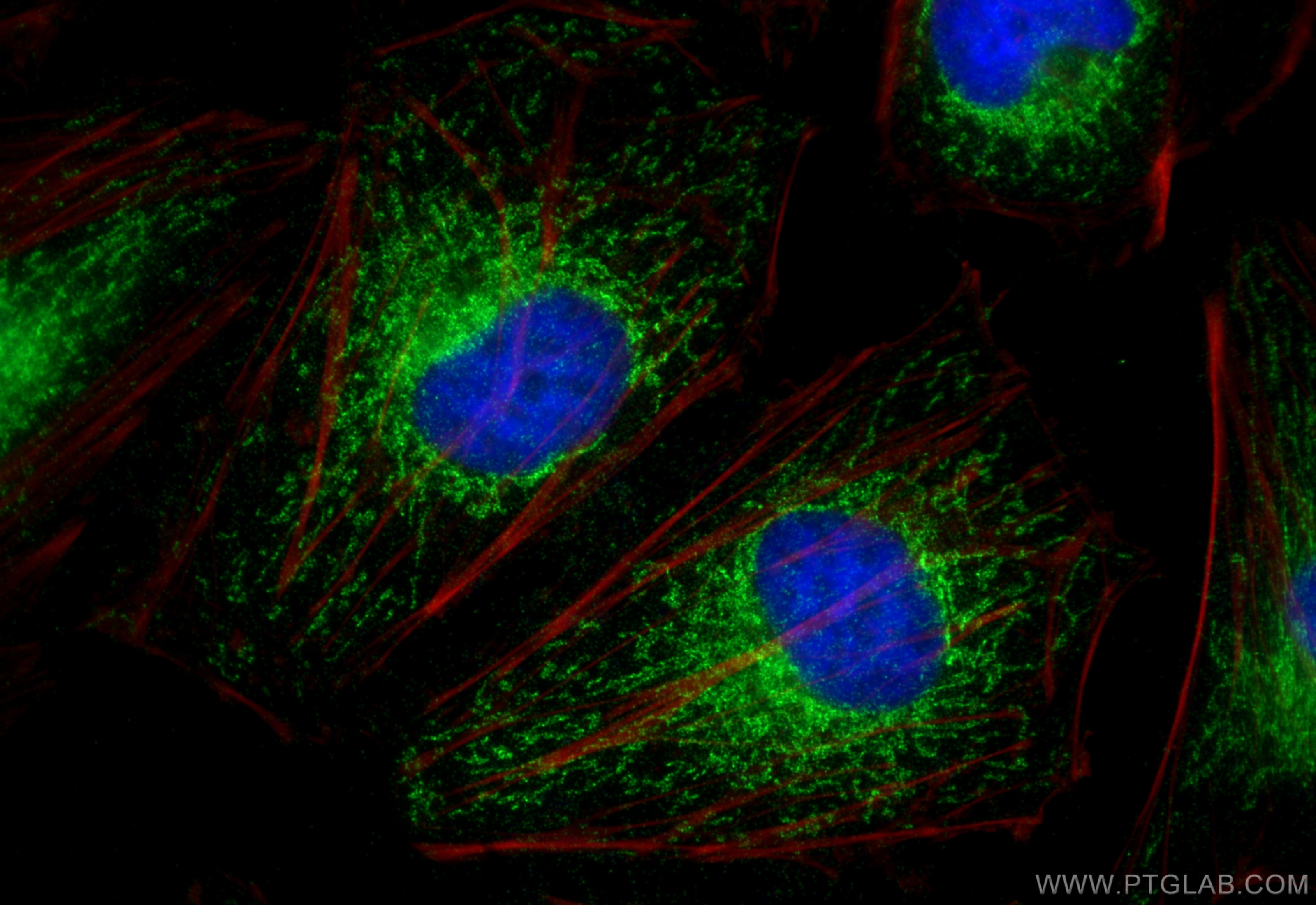 Immunofluorescence (IF) / fluorescent staining of HeLa cells using GFM2 Polyclonal antibody (16941-1-AP)