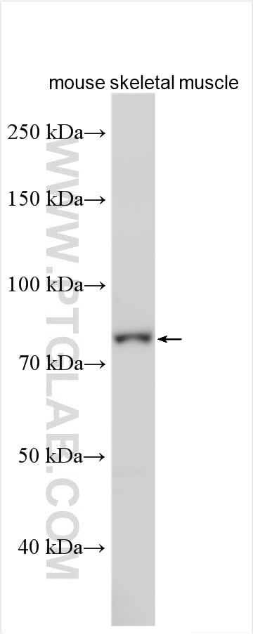Western Blot (WB) analysis of various lysates using GFM2 Polyclonal antibody (16941-1-AP)