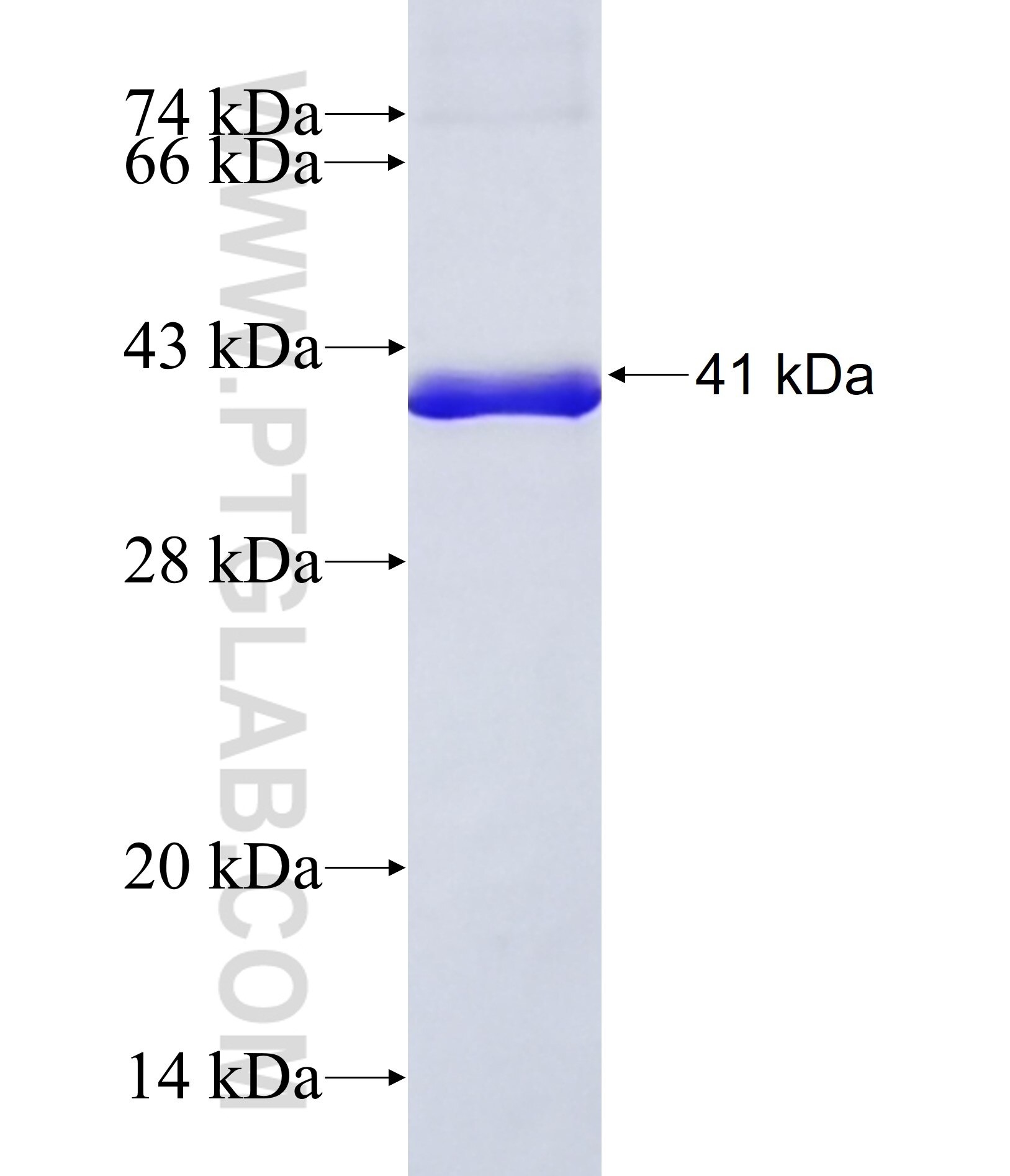 GFM2 fusion protein Ag36976 SDS-PAGE GFM2 fusion protein Ag36976 SDS-PAGE
