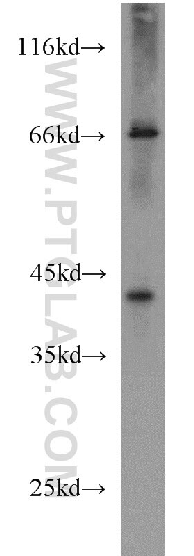 Western Blot (WB) analysis of Jurkat cells using GFOD2 Polyclonal antibody (16340-1-AP)