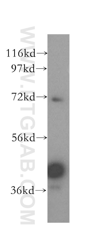 Western Blot (WB) analysis of Jurkat cells using GFOD2 Polyclonal antibody (16340-1-AP)