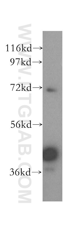 Western Blot (WB) analysis of Jurkat cells using GFOD2 Polyclonal antibody (16340-1-AP)