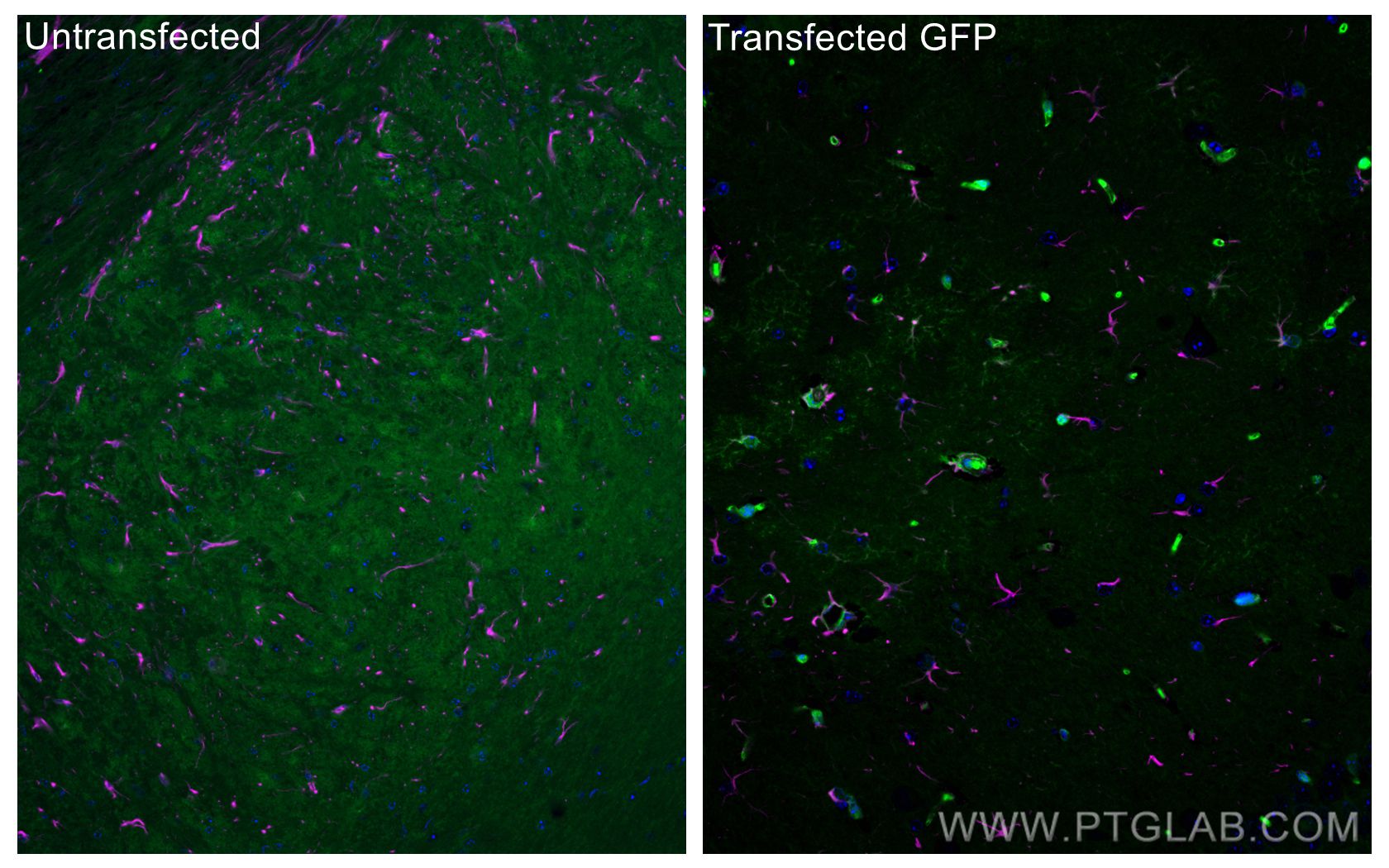 Immunofluorescence (IF) / fluorescent staining of mouse brain tissue using CoraLite® Plus 488-conjugated aequorea victoria GF (CL488-50430)