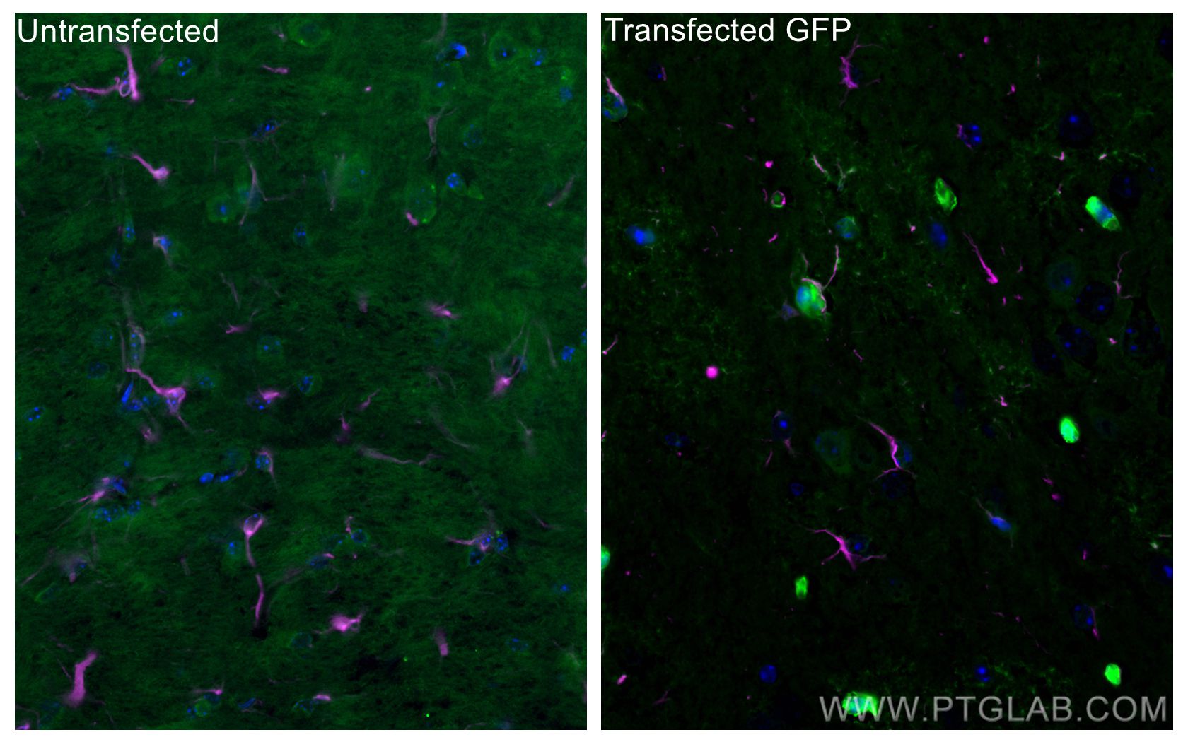 Immunofluorescence (IF) / fluorescent staining of mouse brain tissue using CoraLite® Plus 488-conjugated aequorea victoria GF (CL488-50430)